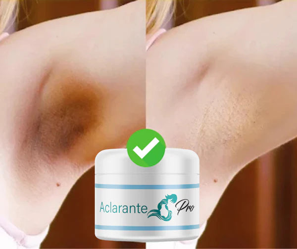 CREMA ACLARANTE S-PRO